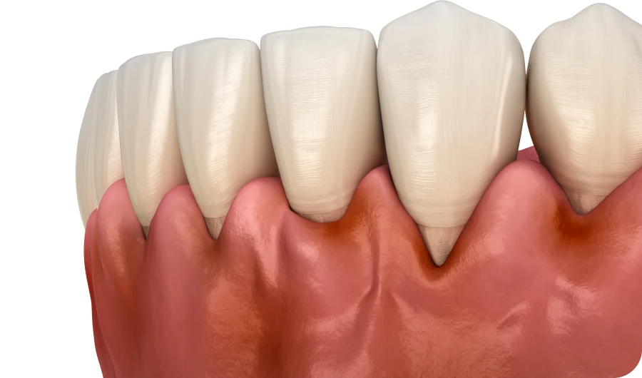 parodontite pahtologies docteur sierocki