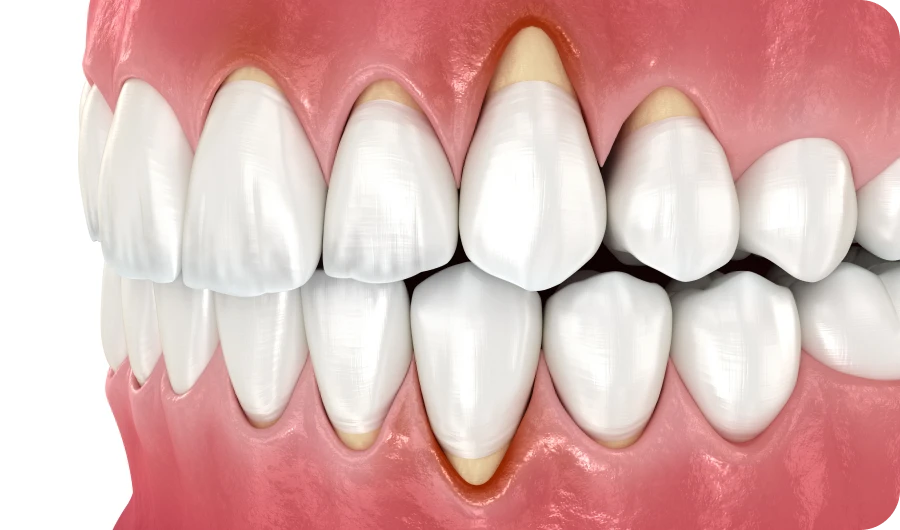 Dentiste Valenciennes 59300